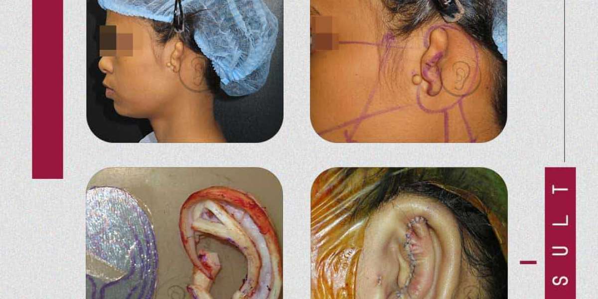 ear surgery in india,ear surgery in Mumbai.