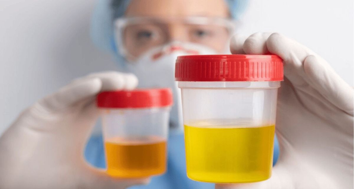 How Long Does Marijuana Stay In Urine? Understanding Different Cannabis Testing Methods – Cannabis Updates, News & Insights