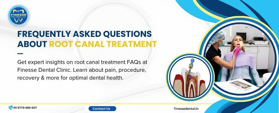 FAQs About Root Canal Treatment