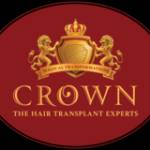 Crown hair Profile Picture