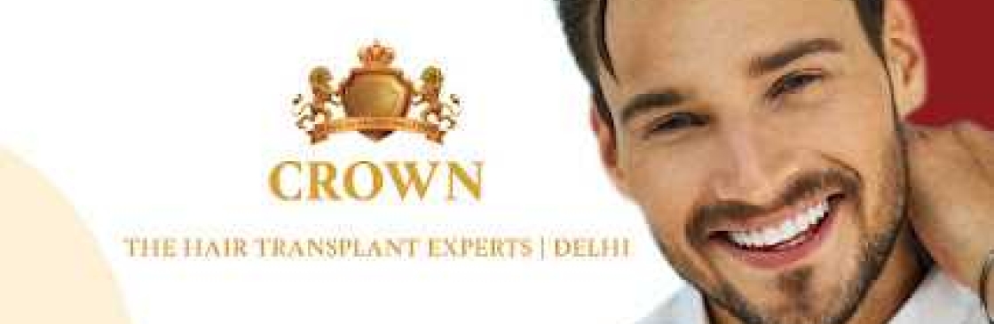 Crown hair Cover Image